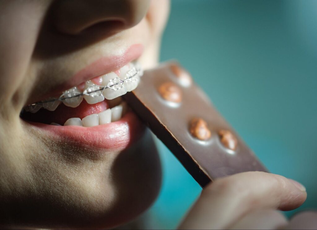 Which Foods Should I Avoid To Prevent Damage To Braces?