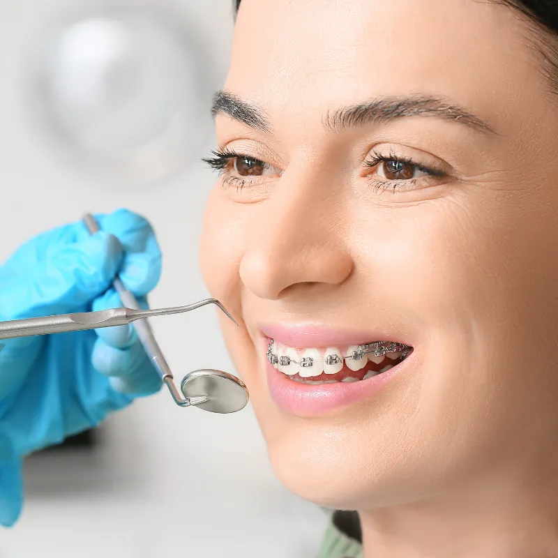 Clear Braces vs. Invisalign and Traditional Braces: Treatment Options, Benefits, and Cost