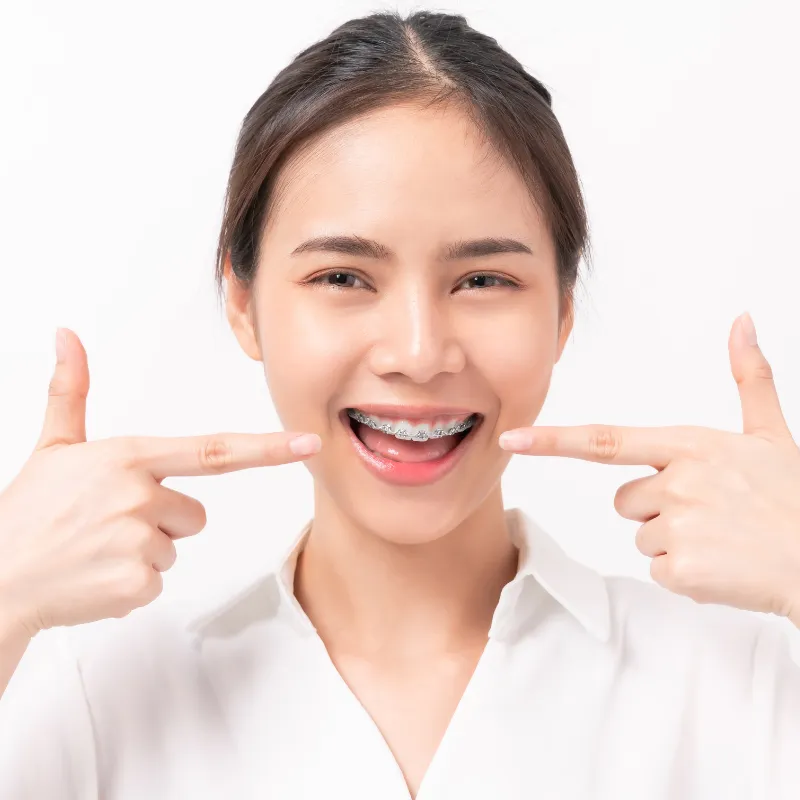 Clear Braces vs. Invisalign and Traditional Braces: Treatment Options, Benefits, and Cost